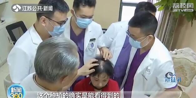 花一万多植发一年后头发没了,花4万植发却发现缺一块