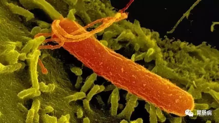 幽门螺杆菌为什么杀不死,幽门螺杆菌根除失败后的补救方案