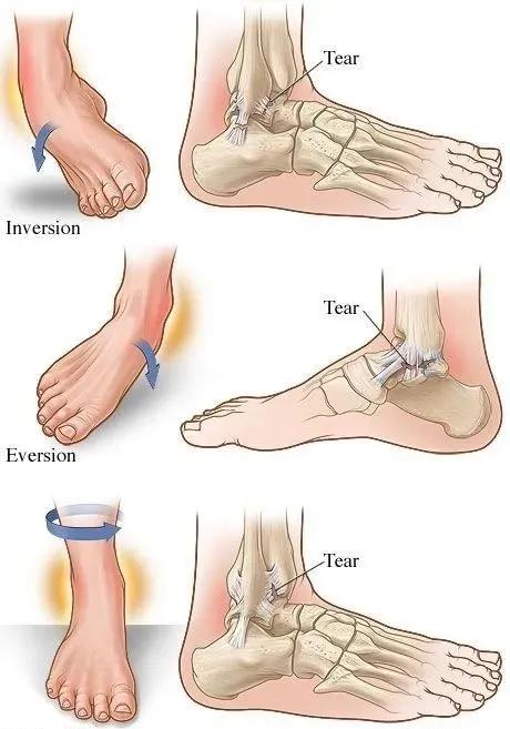 跑步者如何锻炼膝盖,跑步运动员如何力量训练