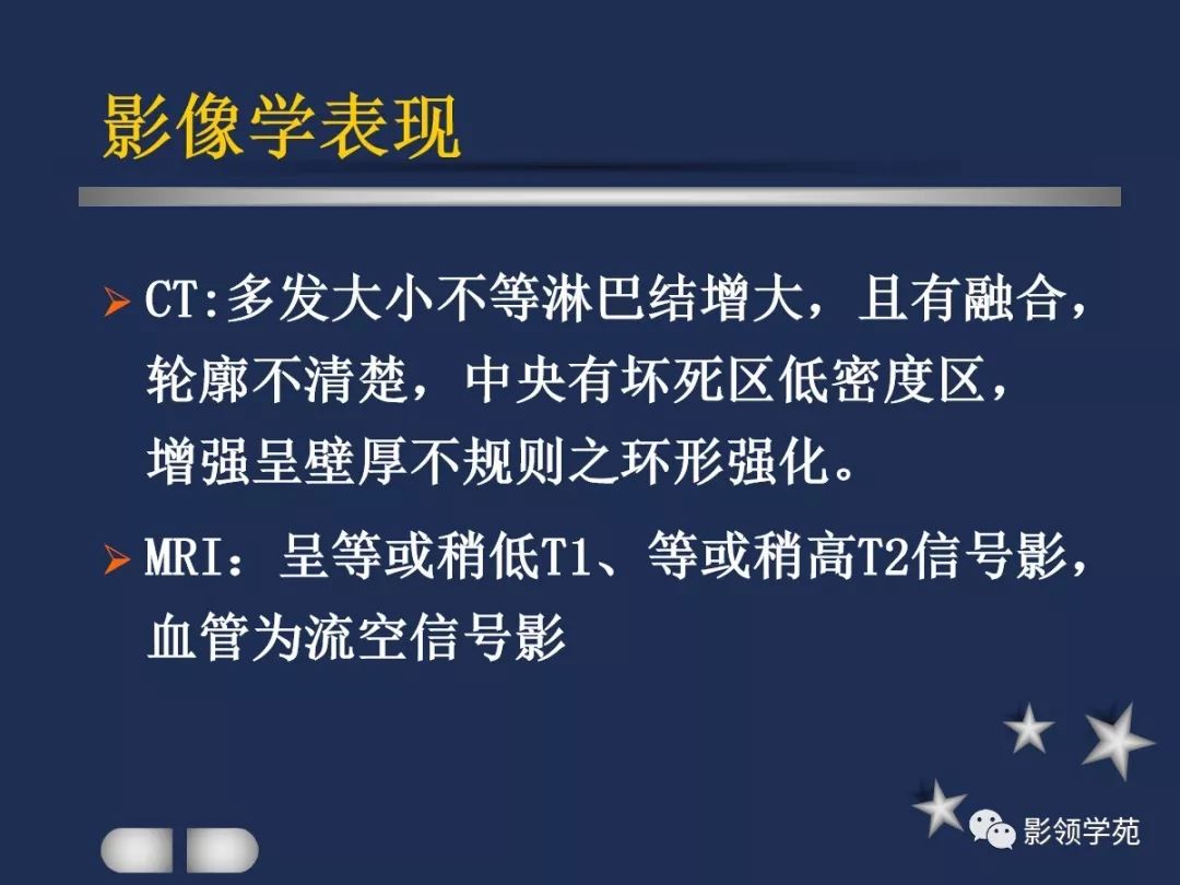 腮腺疾病影像学诊断,腮腺肿块影像诊断