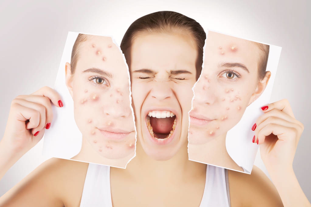 如何区分肌肤的敏感和过敏现象,敏感肌肤总是反复过敏怎么办