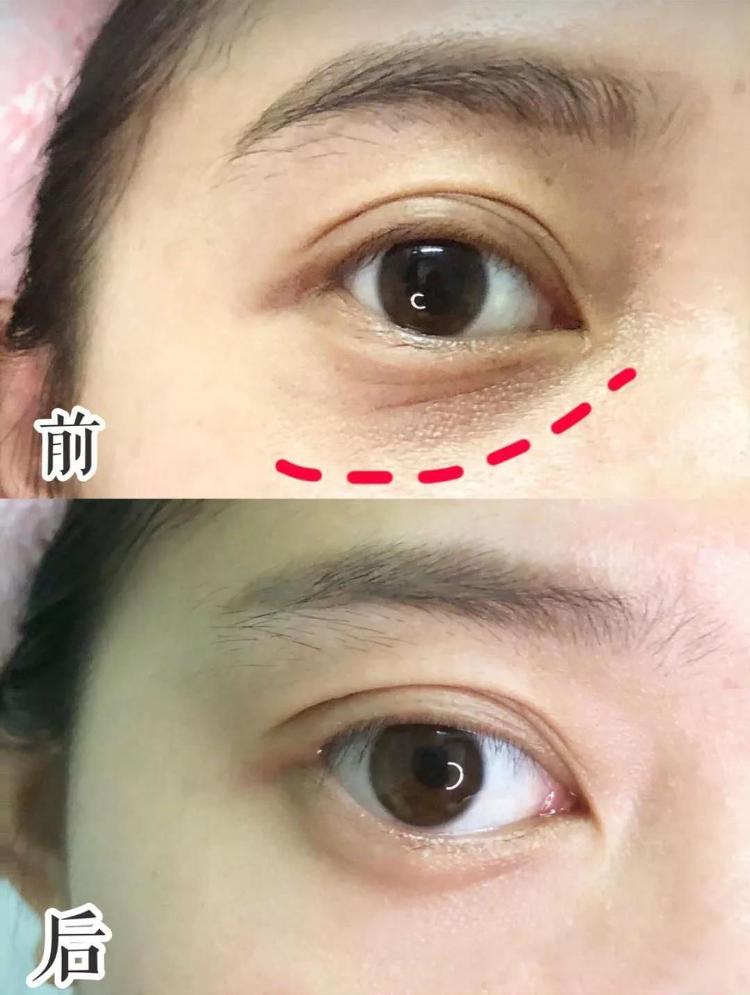 陈乔恩为什么越来越漂亮,陈乔恩肌肤娇嫩