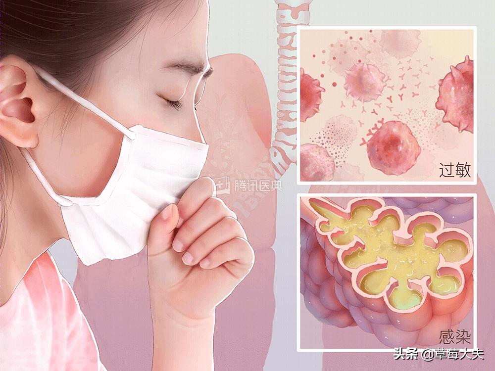 宝宝感冒咳嗽可以用艾叶水洗澡吗,孩子咳嗽两个月不好