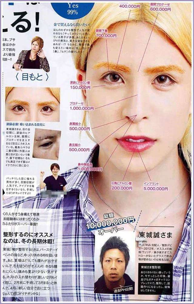日本第一男公关整容前照片,日本第一男公关整容