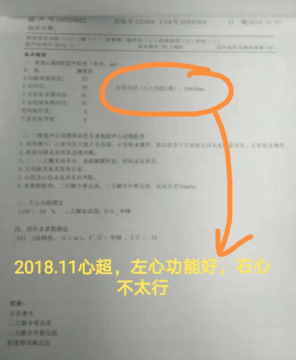 心血管病人吃伟哥,心血管病人可以用伟哥吗