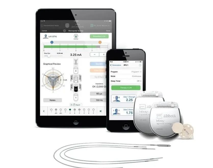 神经调控技术发展前景,神经调控前沿疗法