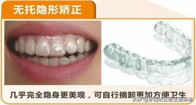 高龄整牙隐适美,整牙隐适美和钢丝牙套区别