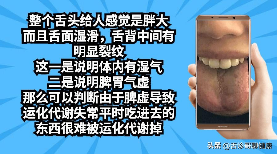 舌诊哥:遗精滑精、气短、虚汗、紧张、焦虑等舌象分析
