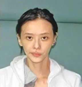 44岁女星被切除器官,44岁女明星剖腹生孩子