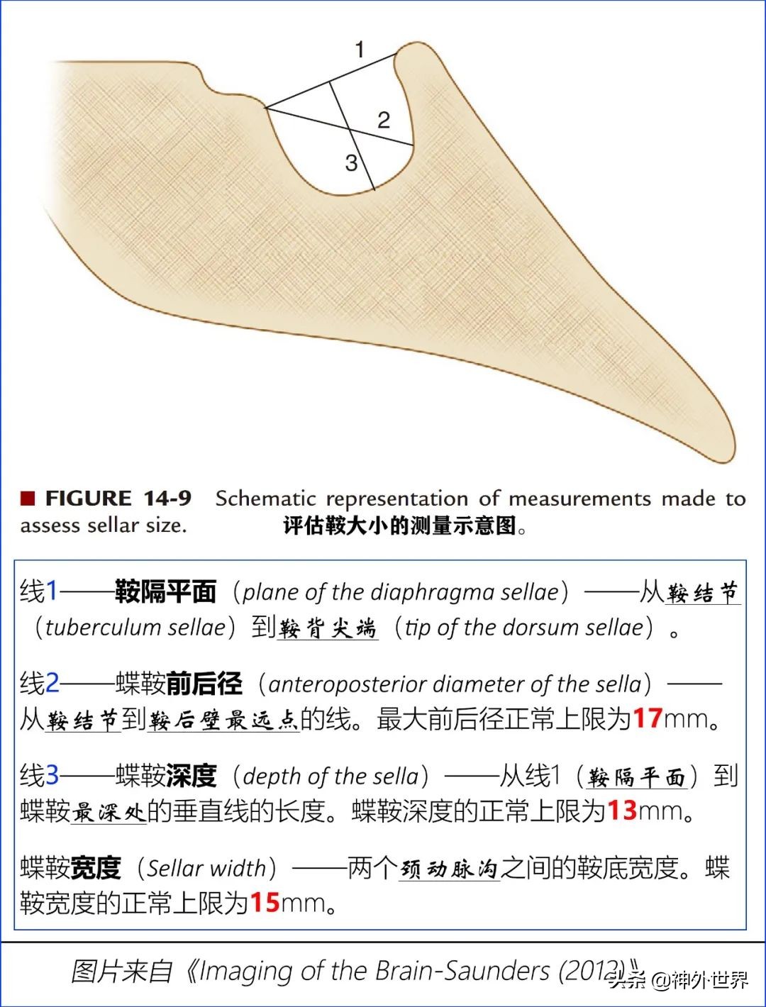 鞍区核磁解剖图,鞍区解剖与手术