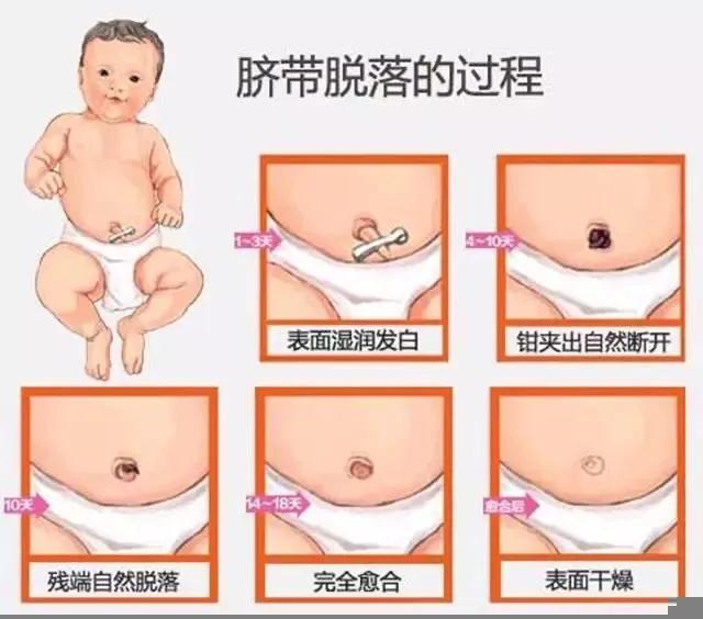 关于宝宝健康的知识,宝宝出生第一天脐带怎么护理
