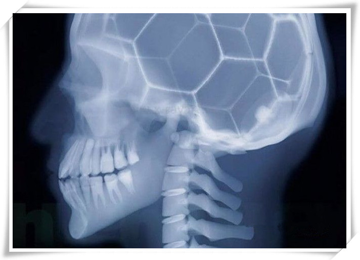 握手、亲吻、喝水、高跟鞋！X射线下人体的样子是啥样？