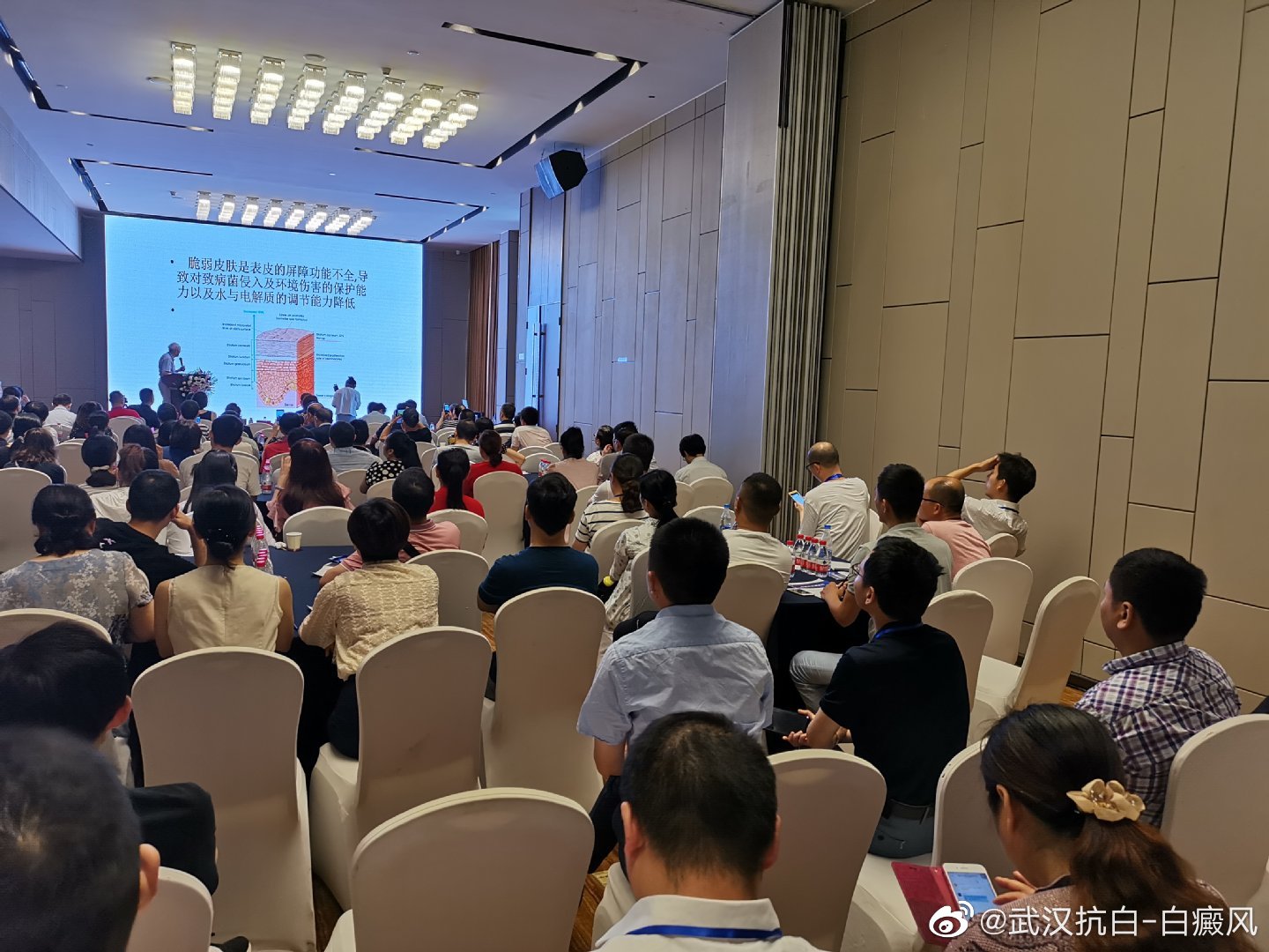 武汉治疗白癜风哪家医院实力强,湖北白癜风医院哪家治疗白癜风好