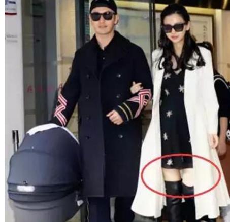 顺产和剖腹产哪个更容易得月子病,坐月子10大禁忌脐部护理