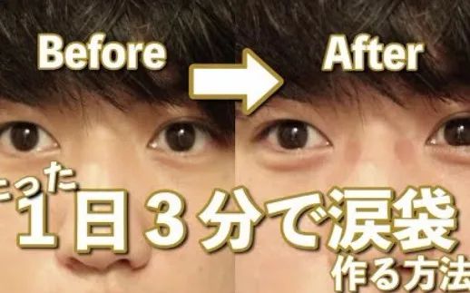 日本双眼皮整形视频,日本整容大师演示