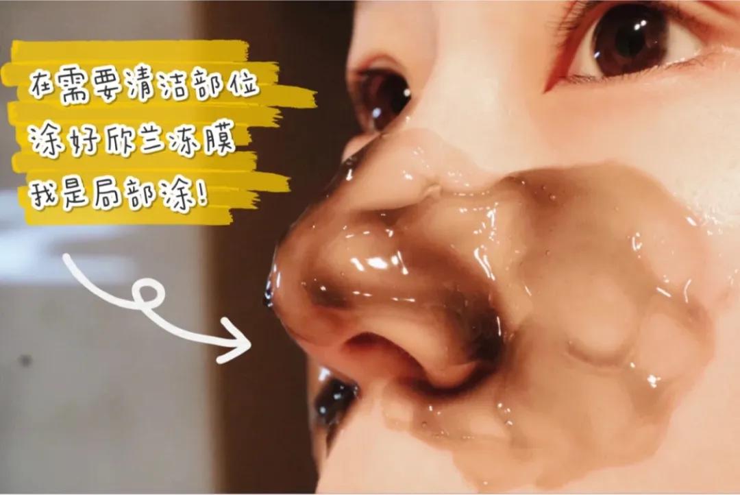 一招教你轻松去黑头,黑头去除小妙招明星