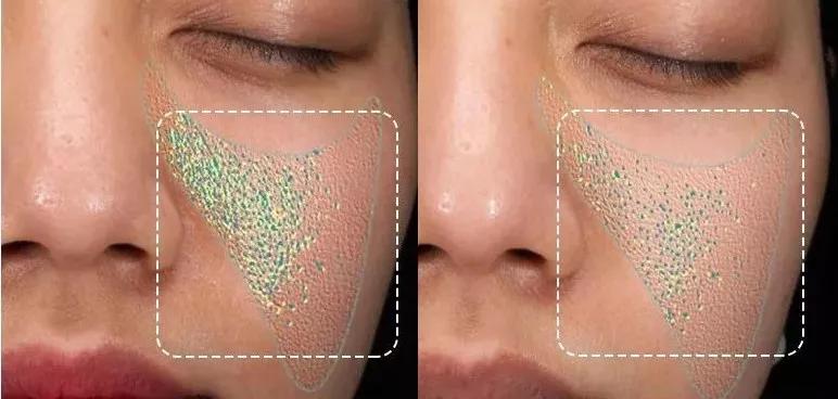 真人改造|不靠医美，一天实现“换皮”