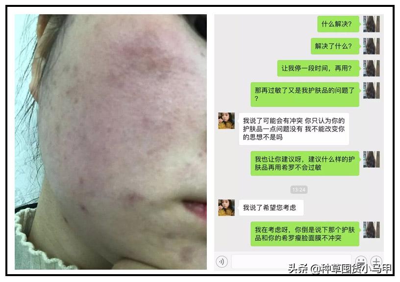 芮一面膜有激素超标吗,网红面膜产品打假测评