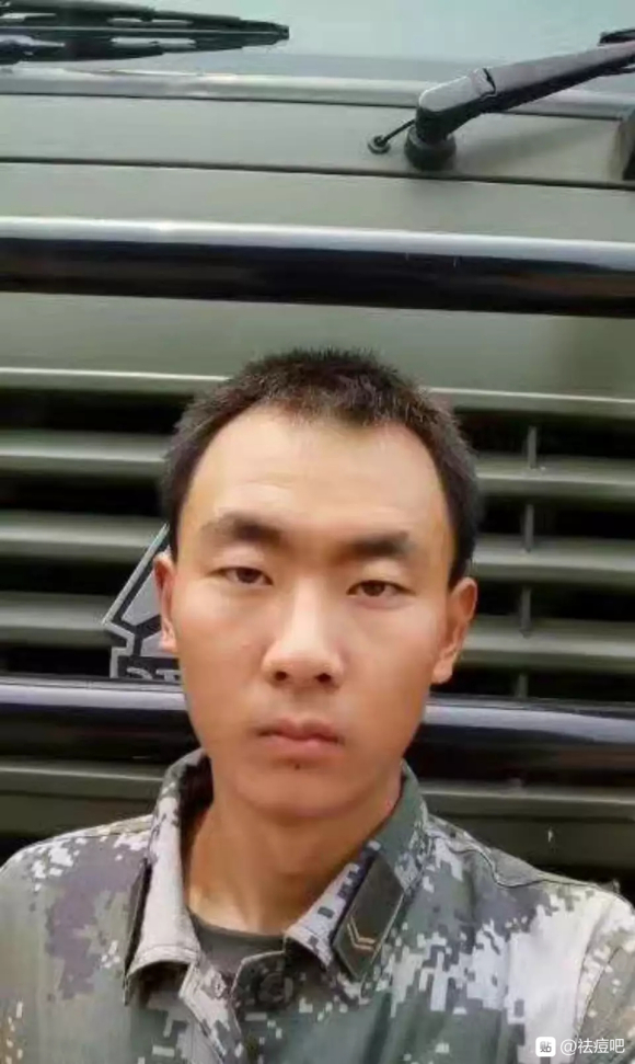 祛痘治疗后恢复,祛痘可以治好痘痘吗