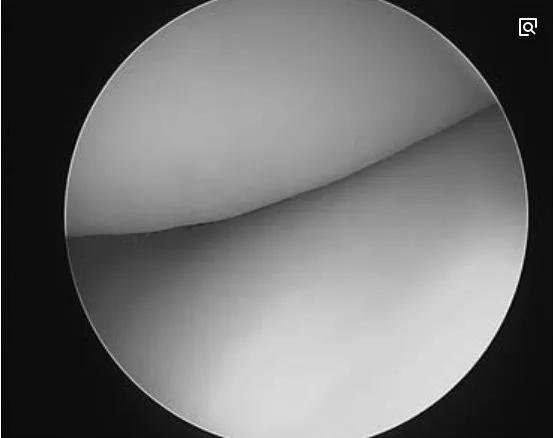 每天爬10楼是利还是弊,每天爬10楼伤膝盖吗