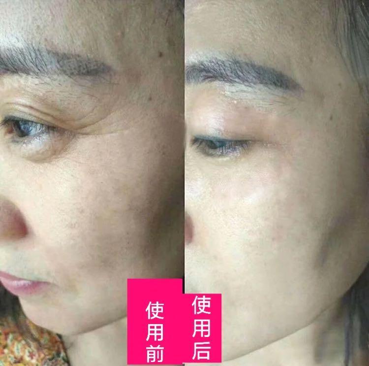 为什么美容院的美白效果那么好,为什么美容院护肤见效快