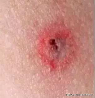 安医大二附院最新消息今天,安医大二附院住院部最新消息