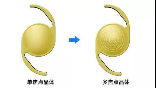 高岩院长做客健康时间——手术治疗白内障的最佳时期是什么时候?