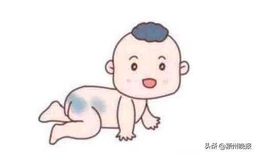 激光祛胎记，深度烧伤成疤痕，家长要求医院赔偿20余万元，法院判赔1.68万余元