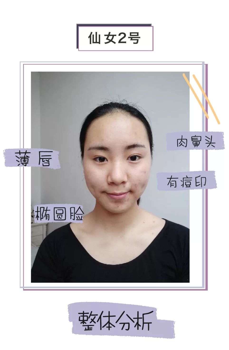 求改善痘痘真实办法,想改变脸上痘痘