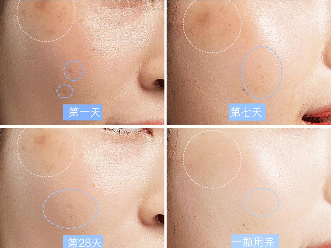 谷雨美白精华能变白吗,什么加美白精华可以变白