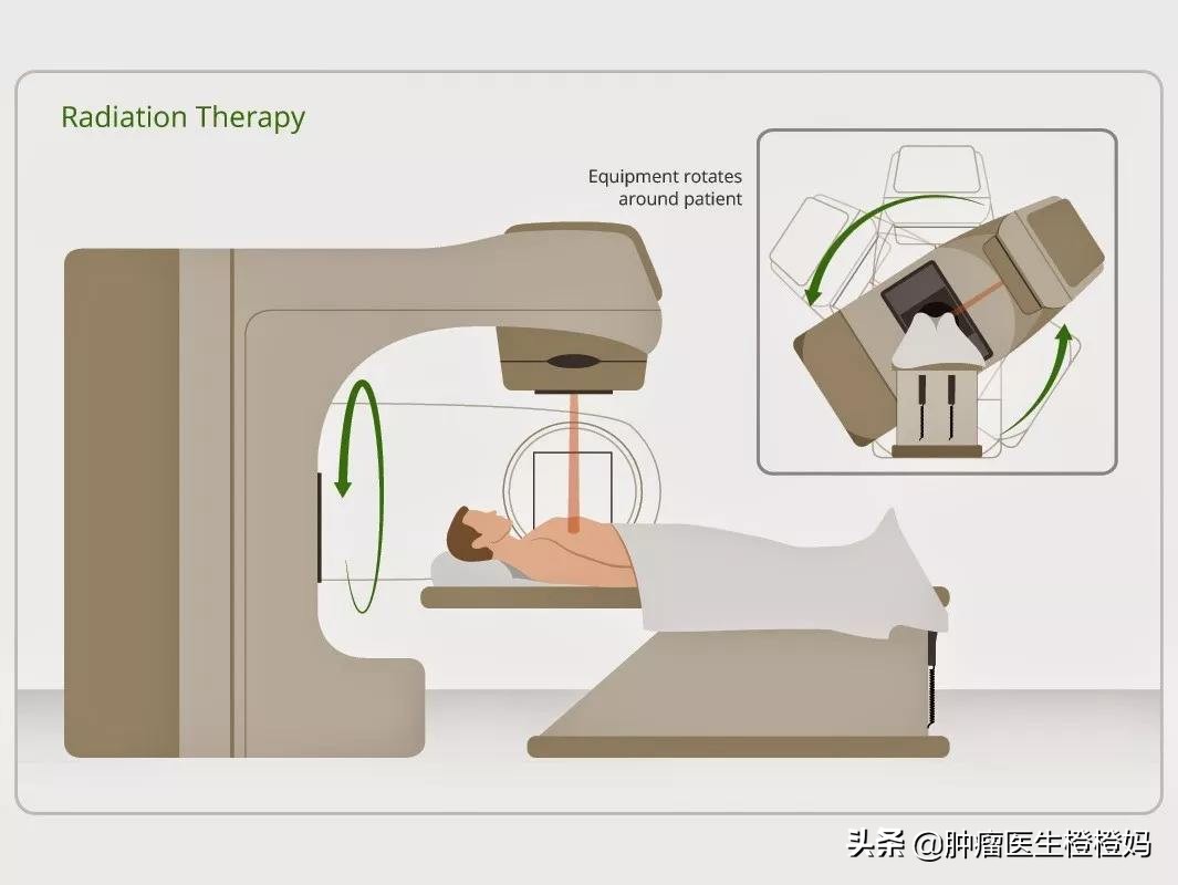 鼻咽癌转移了怎么办?医生告诫定期复查很重要,4种治疗要知道