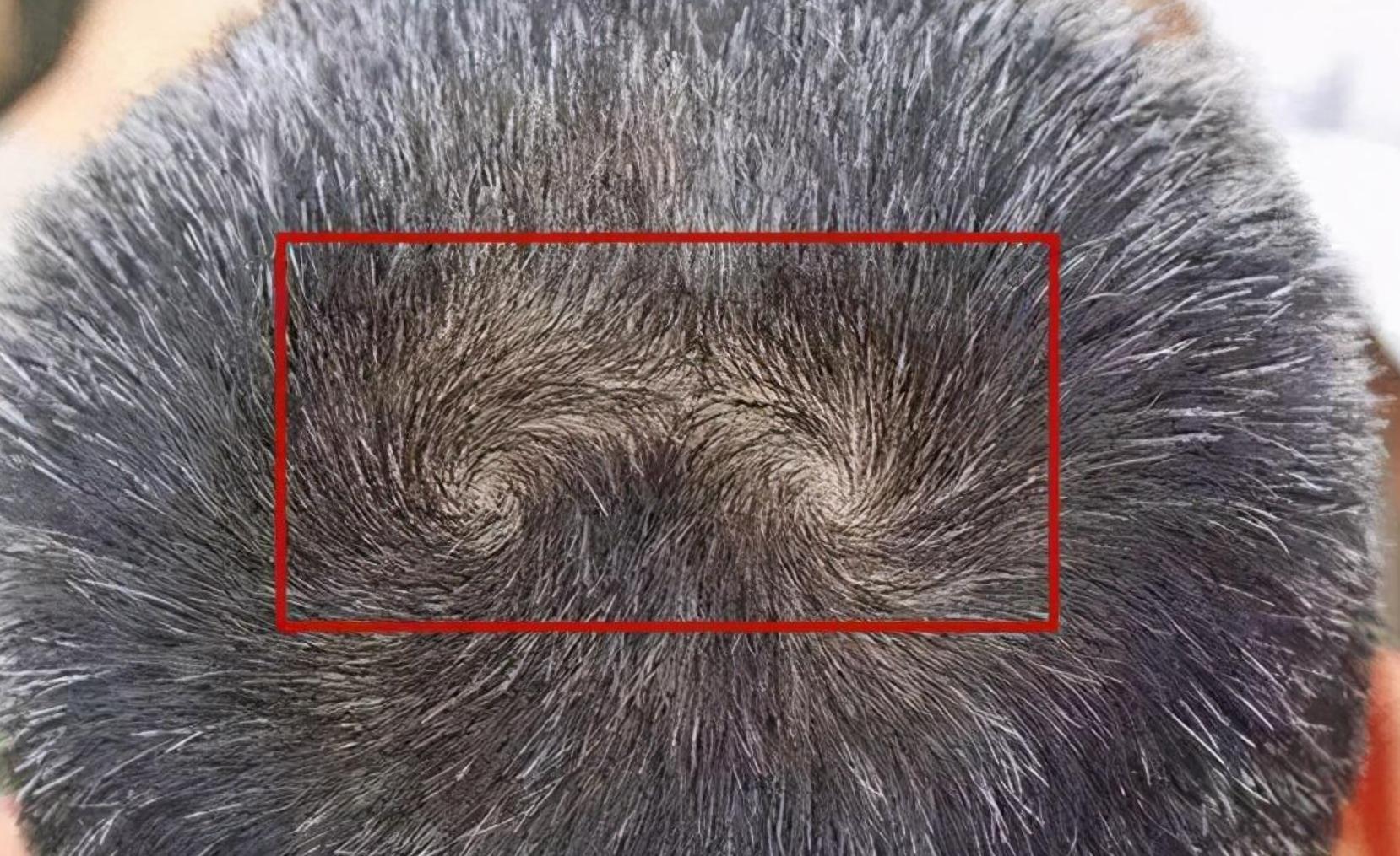 “双旋男孩找不到，双旋女孩没人要”，关于头上的旋，这几点要懂