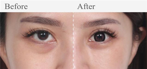 44岁李小冉美颜,李小冉真的是越成熟越美