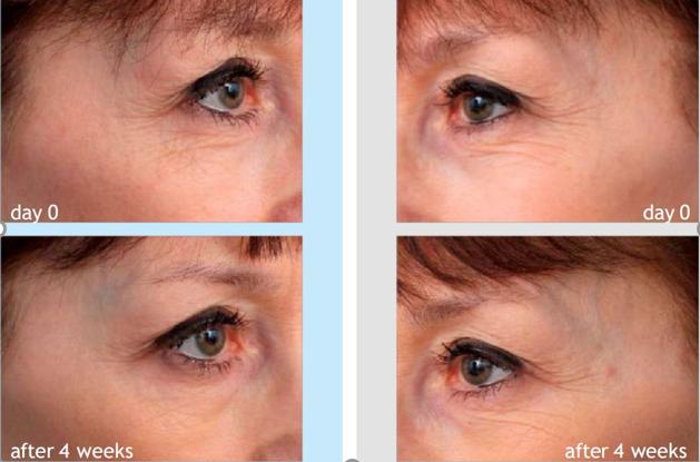 成分*党**特辑：既能修复肌肤还能抗衰抗皱的天然护肤因子—依克多因