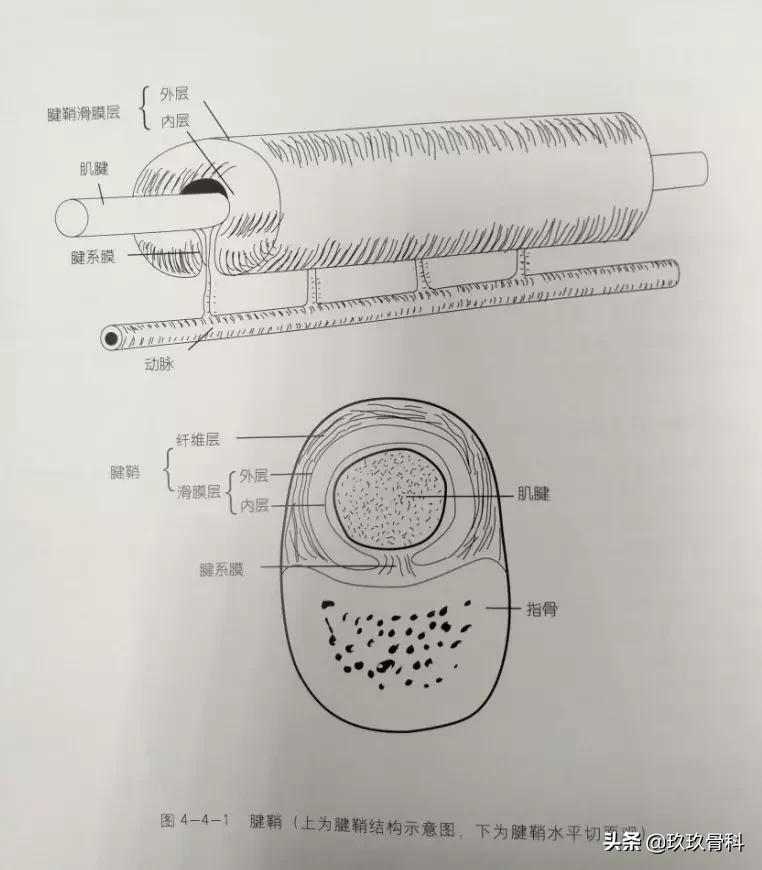 腱鞘囊肿针刺技巧视频,手指腱鞘囊肿正确挤压方法视频