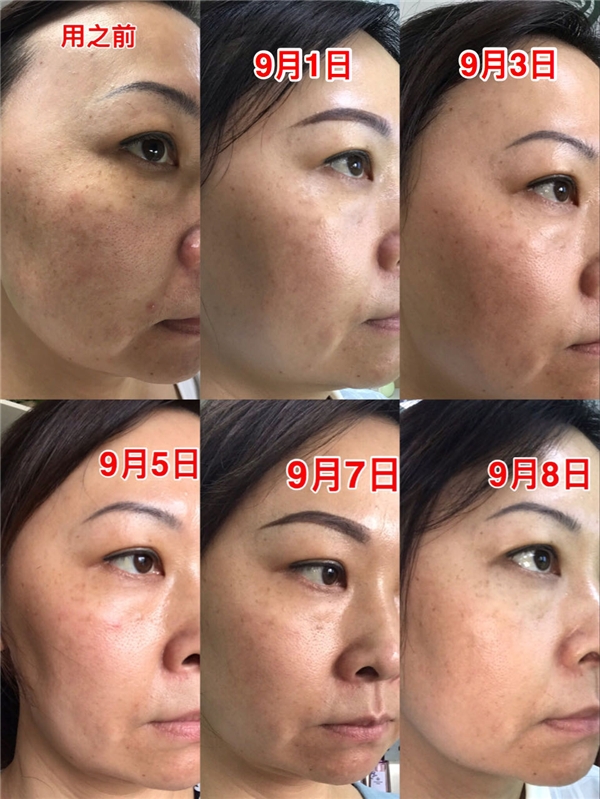 中国中医药非物质文化遗产有哪些,中国非物质文化遗产的中药护肤品