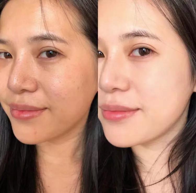 去螨虫慕斯推荐,洗面奶慕斯去螨虫