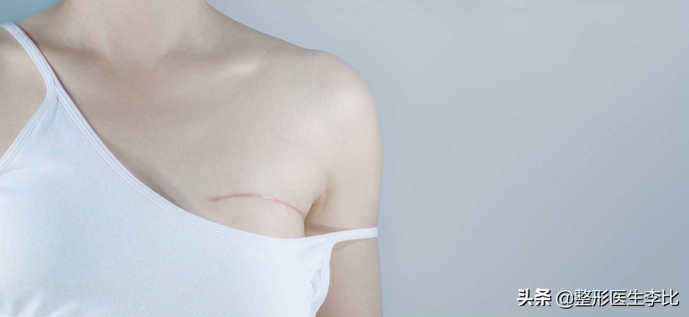 女性失去乳房后该怎么办？