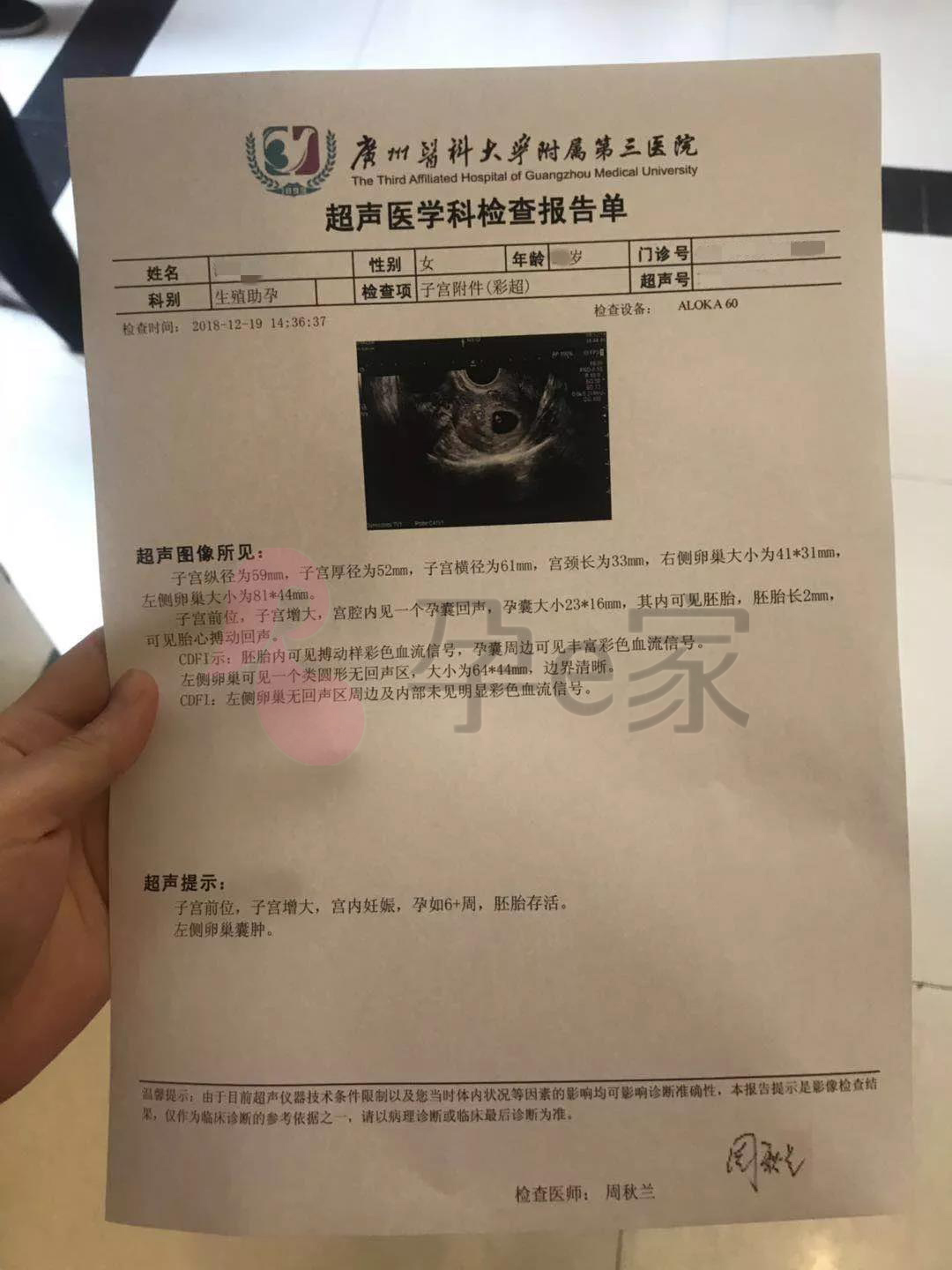 多囊怀孕血泪史：如果扎100针才能换来宝宝，你肯吗？