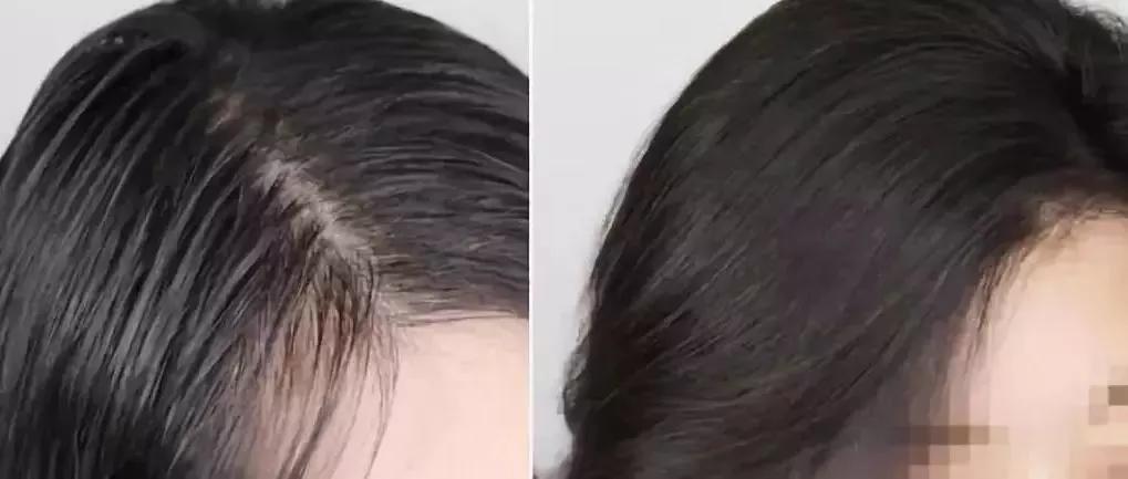 细软发质贴头皮,发量少显蓬松的神器