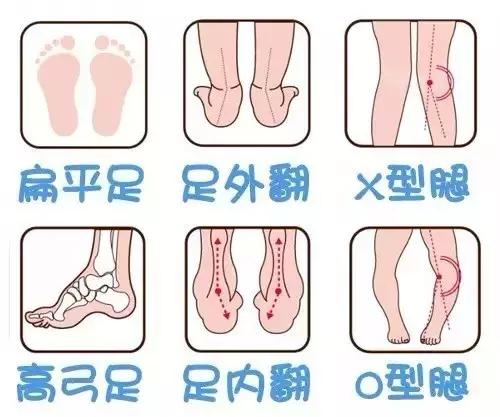 这3种鞋千万别给孩子穿,不要给孩子穿这四种鞋
