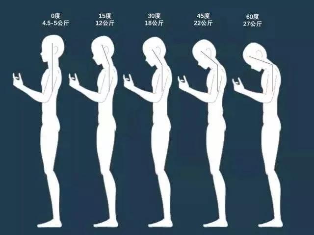 颈椎病不用怕1分钟颈肩操,别低头肩颈会痛