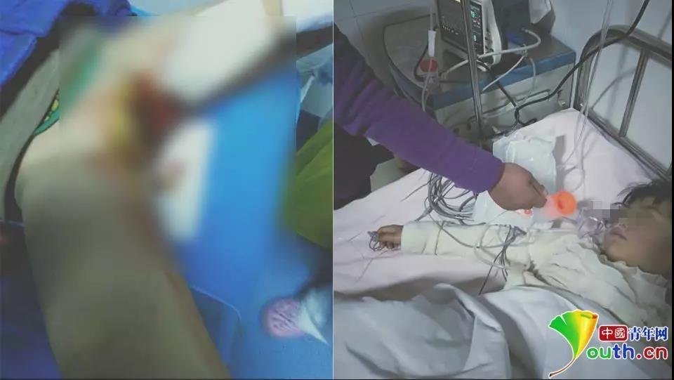 女孩被打至*体下**出血?幼童惨遭校园霸凌,网友:老师也信不过?