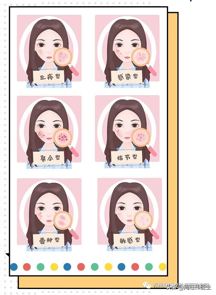 青春痘临床分级,15岁女生青春痘用什么护肤产品