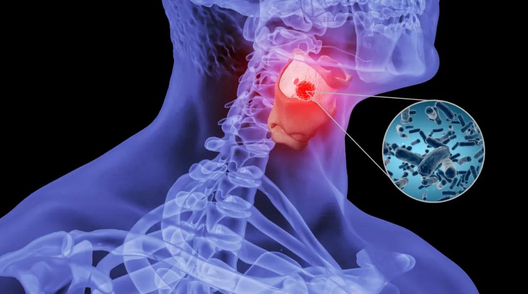 儿童清热解毒润喉茶,润嗓子清热解毒茶民间