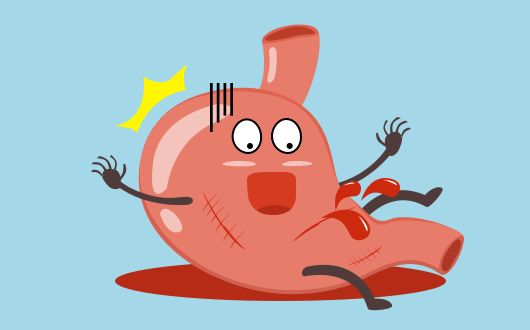 胃酸胃出血饮食应该注意什么,胃出血脑梗后期饮食注意什么