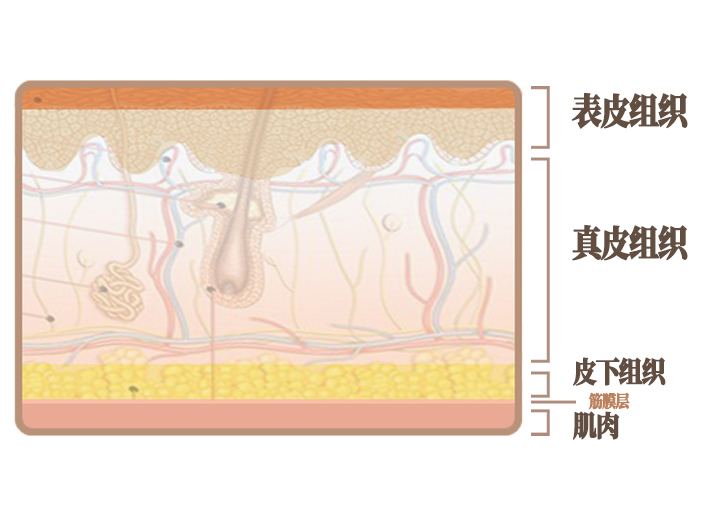 线雕疼痛到什么程度,面部线雕后疼痛