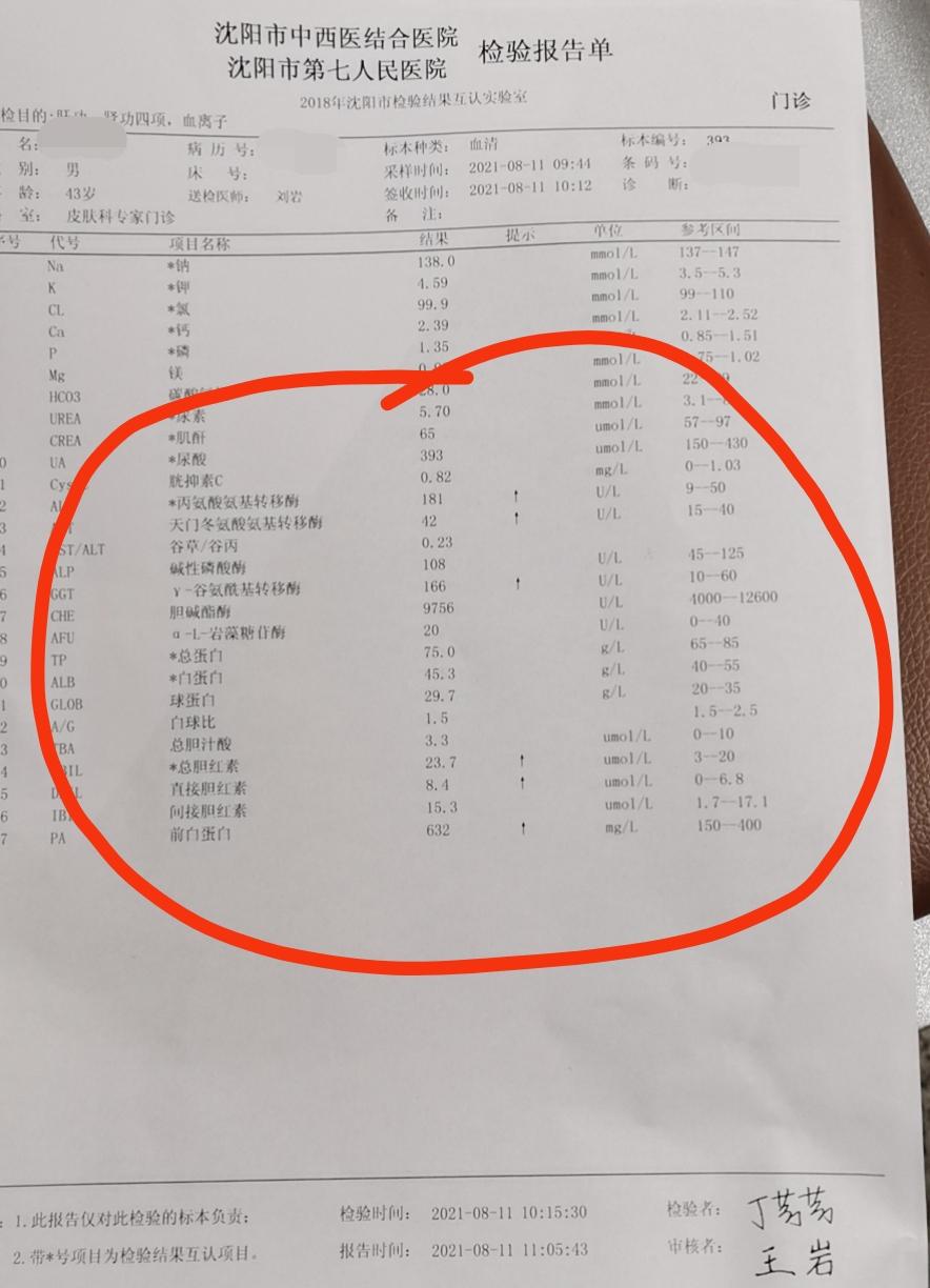 接触性皮炎和肝脏有没有关系,接触性皮炎不治疗会扩大吗