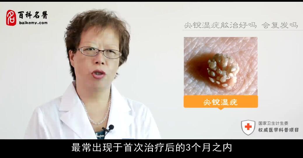 尖锐性湿疣能治好吗会复发吗,尖锐性湿疣治好会复发吗