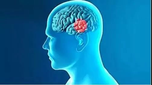 患上帕金森不要怕,科学治疗帕金森让你从此不怕